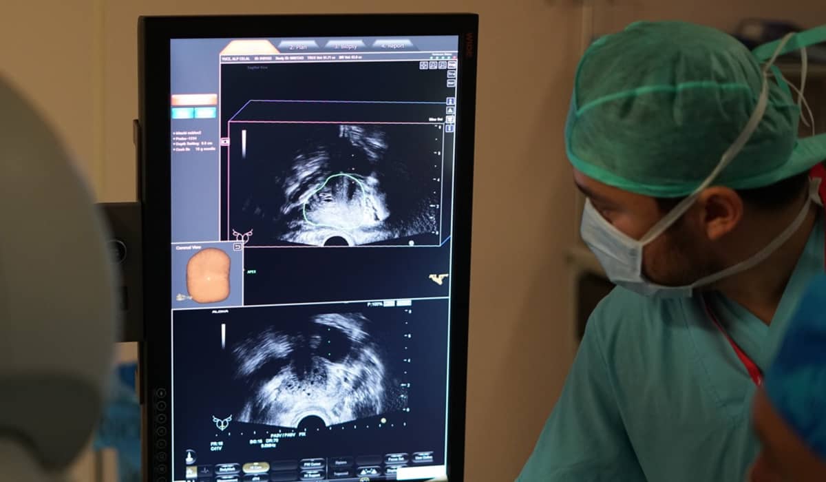 Prostat Füzyon Biyopsisi