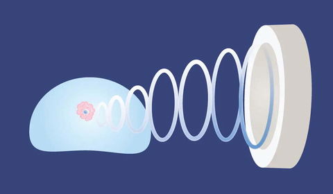 Prostat Büyümesi (HoLEP)
