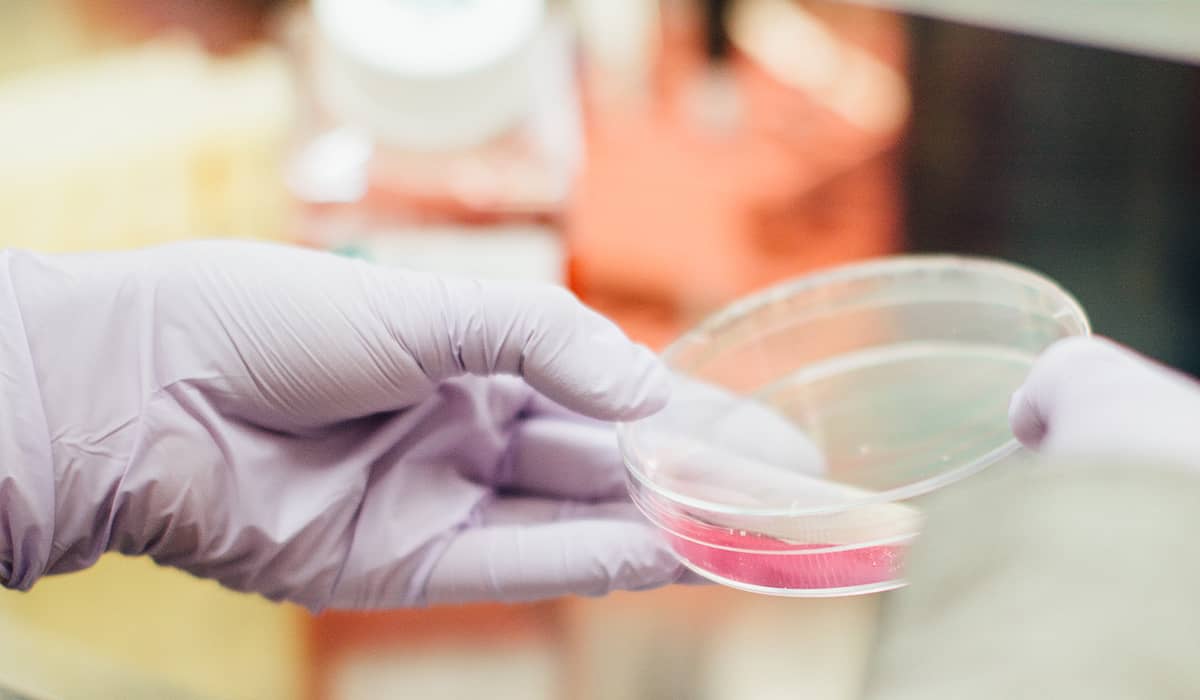 Prostat Kanserinde PSMA PET Nedir?