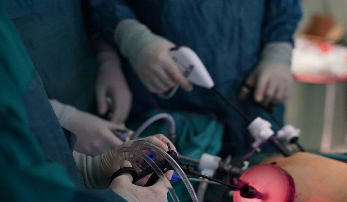 Radikal Sistektomi Ameliyatı