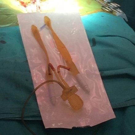 penil protez silindirleri