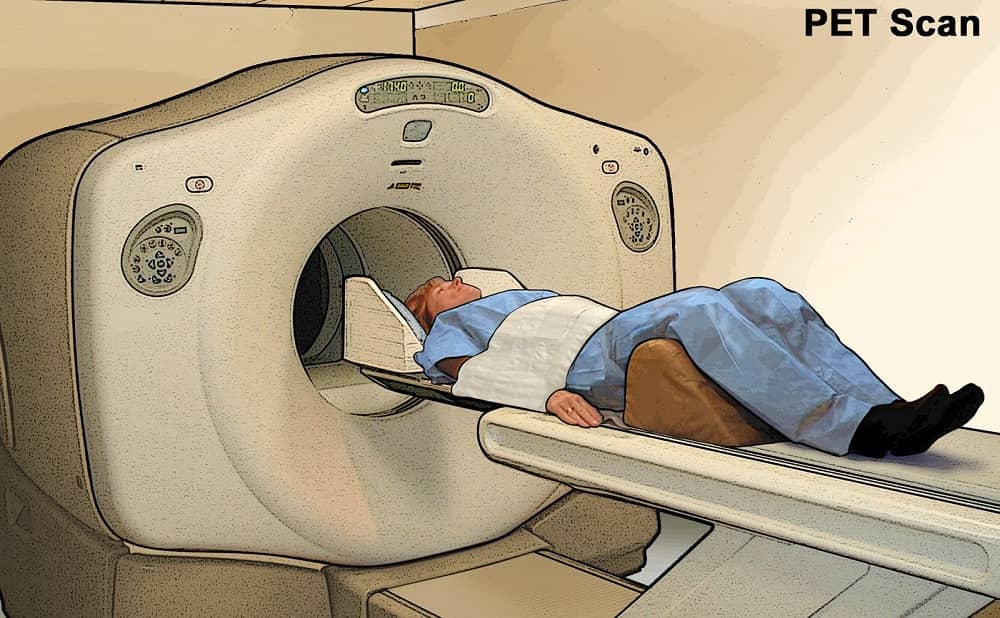 PET Scan Makinesi