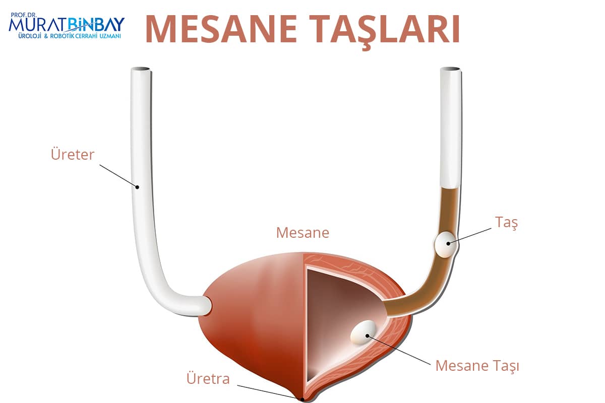 Mesane Taşları