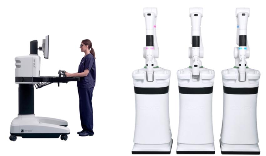 Versius robotik cerrahisi