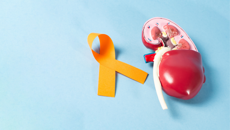 RCC (Renal Hücreli Karsinom) Yaşam Süresi