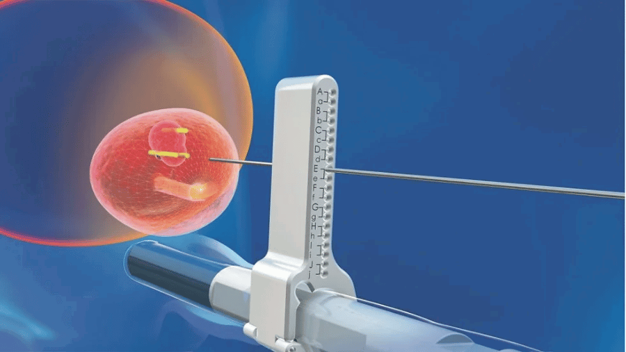 MR-TRUS Füzyon Prostat Biyopsisi Nedir?