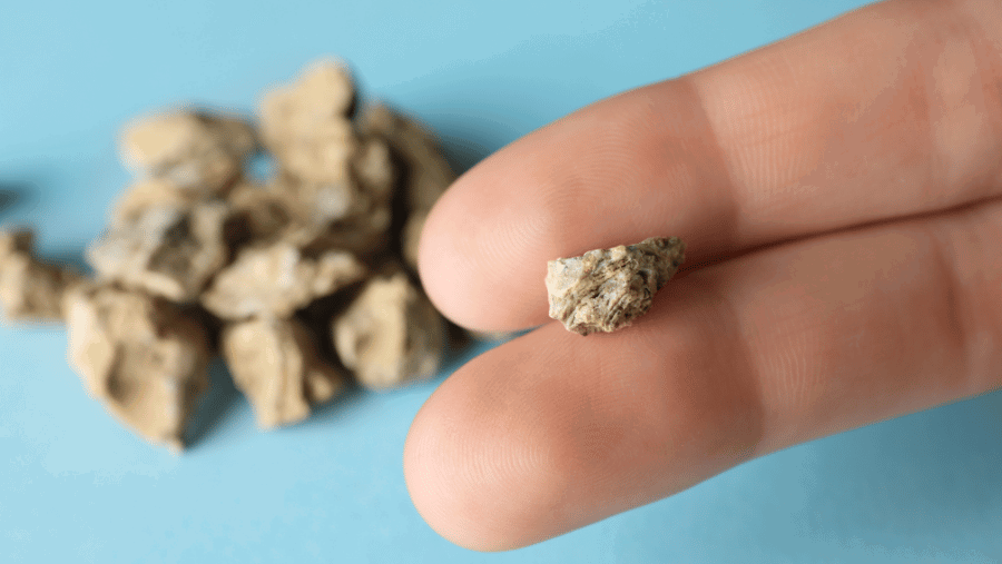 Böbrek Taşının Tekrar Oluşmaması İçin Alınabilecek Önlemler