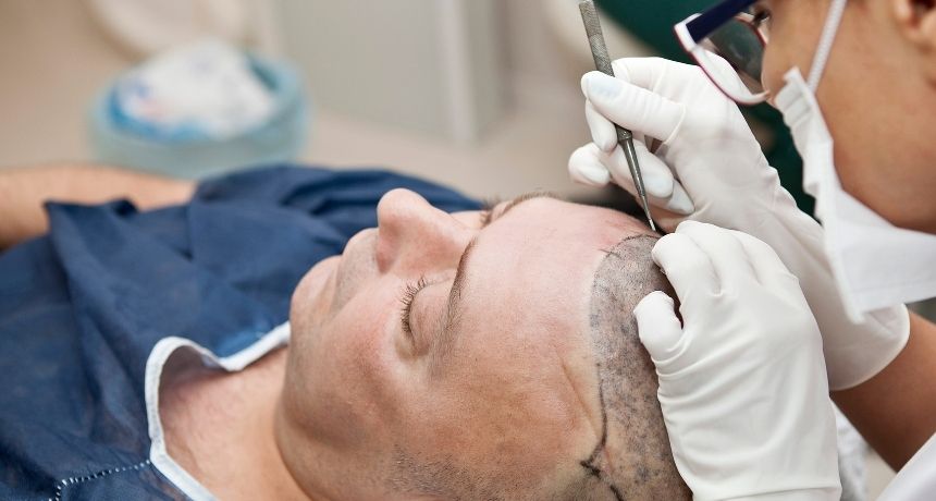 hair transplant hospital health