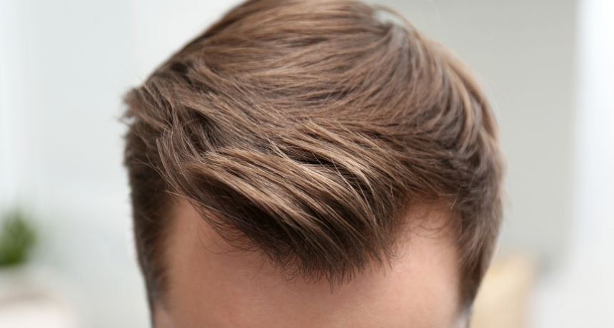 hair transplant health 